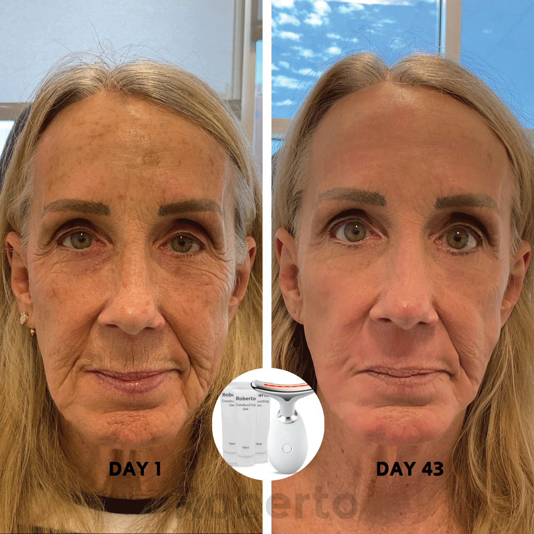 Roberto™ Device + Conductive Gels