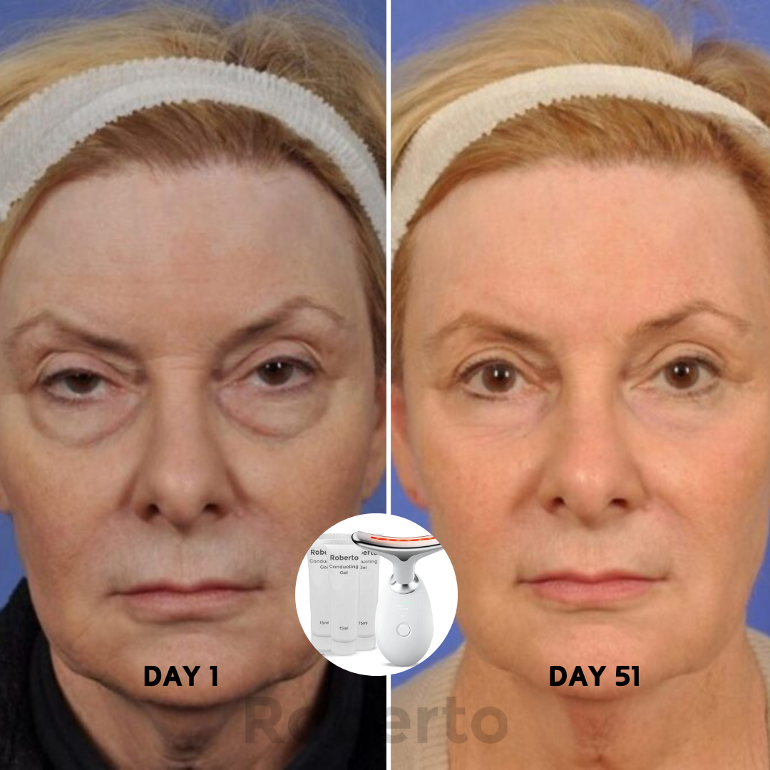 Roberto™ Device + Conductive Gels