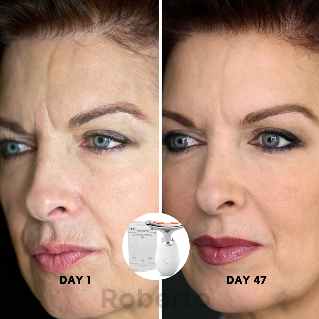 Roberto™ Device + Conductive Gels