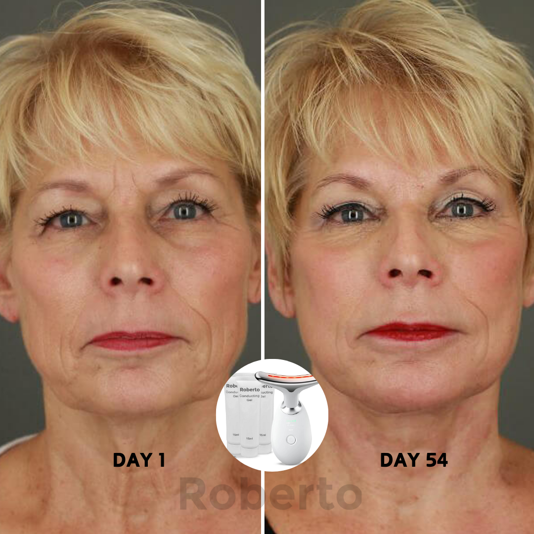 Roberto™ Device + Conductive Gels