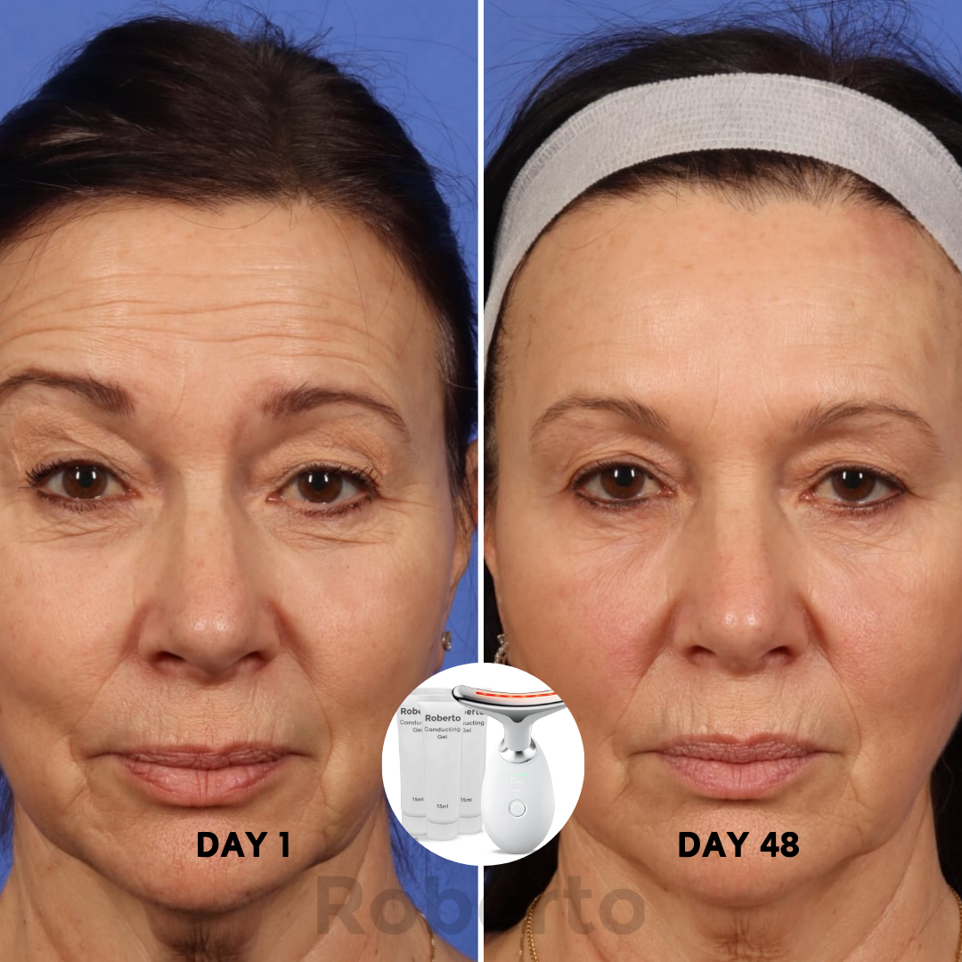 Roberto™ Device + Conductive Gels