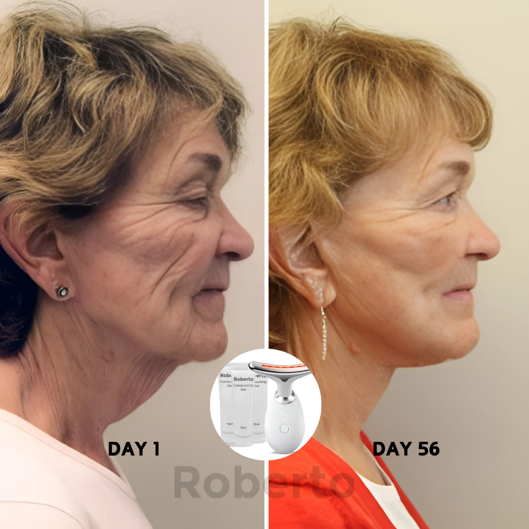 Roberto™ Device + Conductive Gels